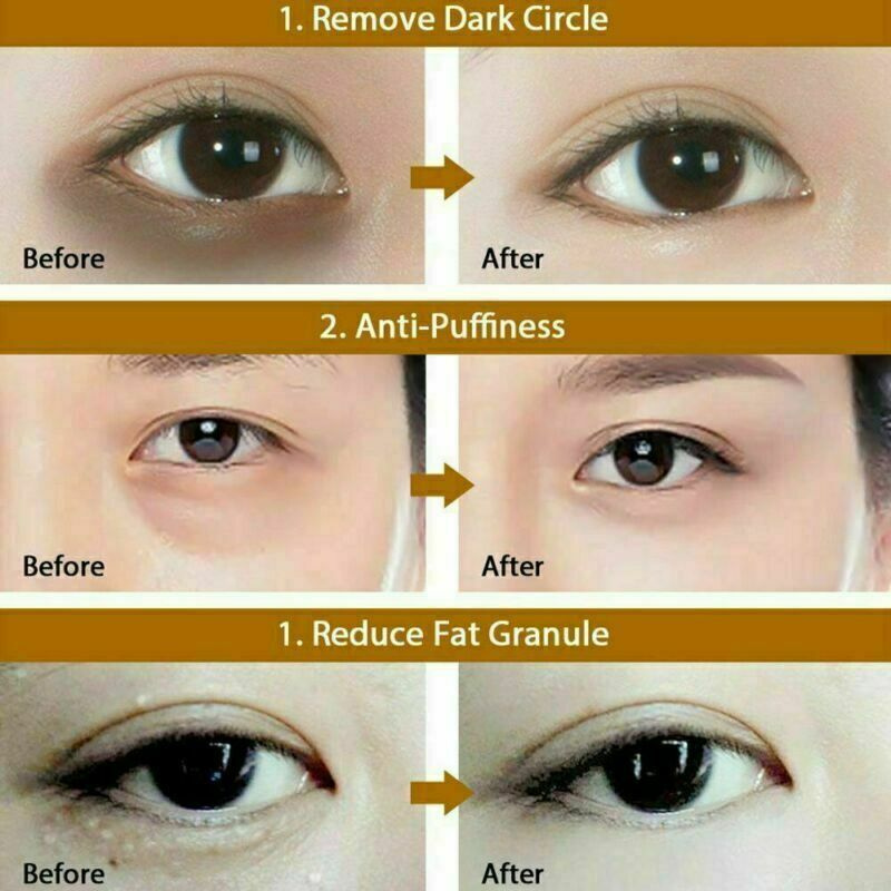 EffortlesSkinTherapy™ Collagen Eye Patches